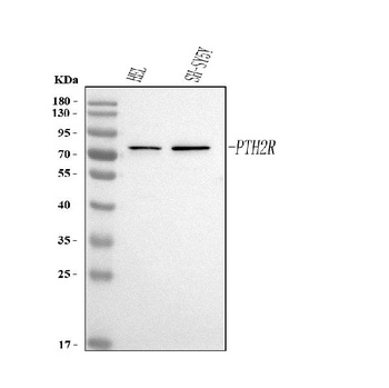 Anti-PTH2R Antibody