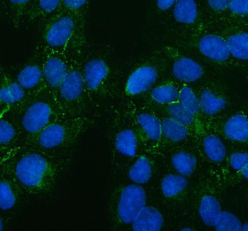 Anti-PTH2R Antibody