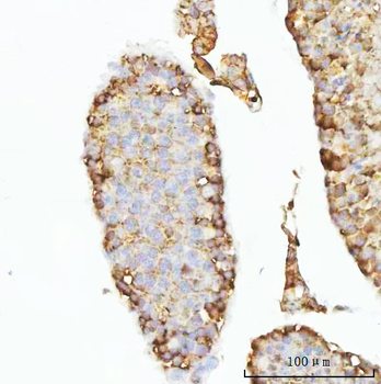Anti-GHRH Antibody