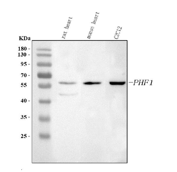 Anti-PHF1 Antibody