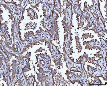 Anti-CCL15 Antibody