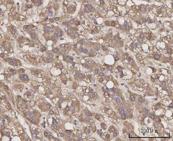 Anti-CCL23 Antibody