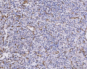 Anti-CXCL1 Antibody