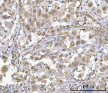 Anti-HOXD10 Antibody