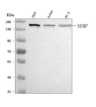 Anti-SDCCAG1/NEMF Antibody