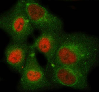 Anti-SDCCAG1/NEMF Antibody