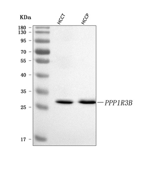 Anti-PPP1R3B Antibody