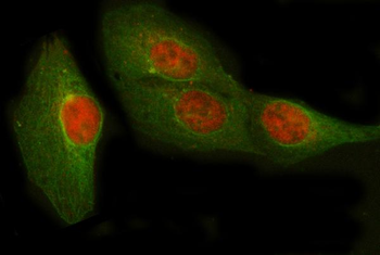 Anti-POLR2D Antibody