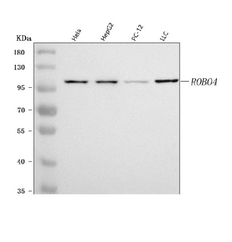 Anti-ROBO4 Antibody