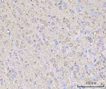 Anti-RPH3A Antibody