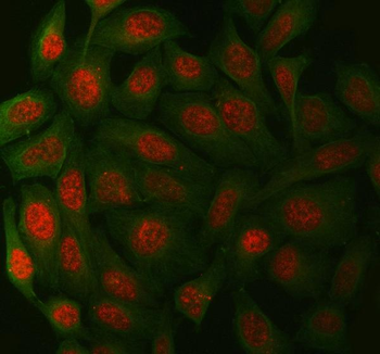 Anti-XPA Antibody