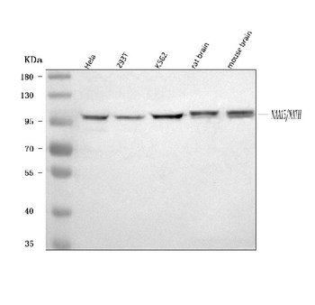 Anti-NARG1/NAA15 Antibody