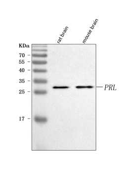 Anti-Prolactin/PRL Antibody