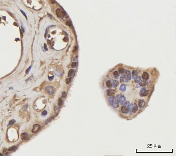 Anti-NEIL3 Antibody