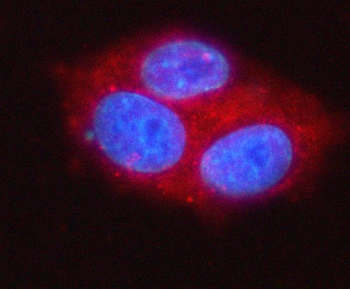 Anti-MOGAT2 Antibody