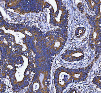 Anti-DAPK1 Antibody