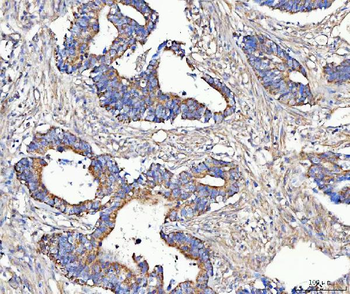 Anti-MCCC2 Antibody