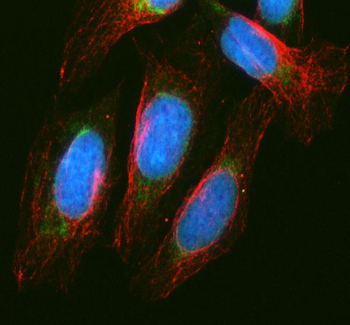 Anti-MCCC1 Antibody