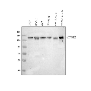 Anti-PPP1R13B Antibody