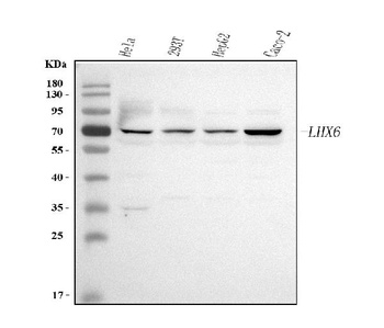 Anti-LHX6 Antibody