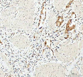 Anti-MYNN Antibody