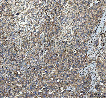 Anti-C19orf10/MYDGF Antibody