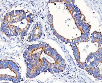 Anti-METAP1D Antibody