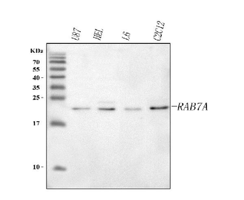 Anti-RAB7A Antibody