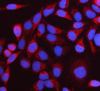 Anti-NTN3 Antibody