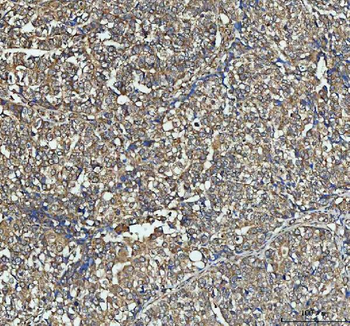Anti-NSG1 Antibody