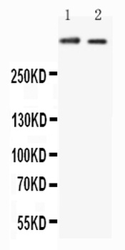 Anti-Huntingtin/HTT Antibody