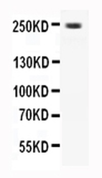 Anti-CaV1.3/CACNA1D Antibody