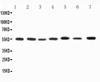 Anti-Kv1.1 potassium channel/KCNA1 Antibody