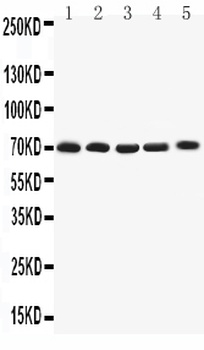 Kv1.4/KCNA4 Antibody