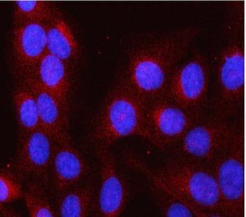 Anti-LAP3 Antibody