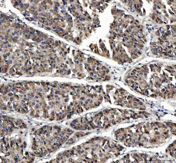 Anti-MAGEL2 Antibody
