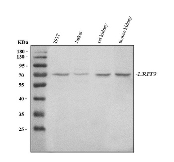 Anti-LRIT3 Antibody