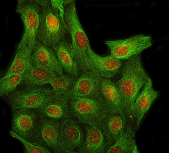 Anti-LRIT3 Antibody