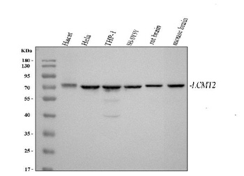 Anti-LCMT2 Antibody