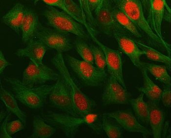 Anti-LAGE3 Antibody