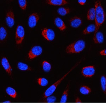 Anti-ATP5F1D Antibody