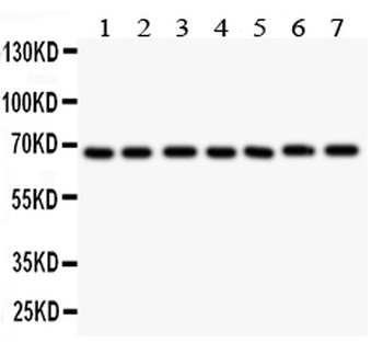 GAD67/GAD1 Antibody