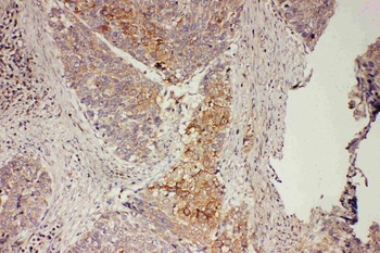 GRB7 Antibody