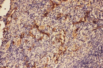 Anti-C5/C5a Antibody