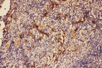 C5/C5a Antibody