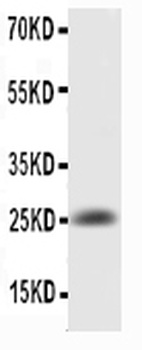 Anti-IL6 Antibody