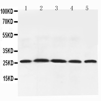 Adiponectin/ADIPOQ Antibody