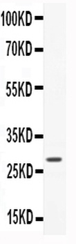 Anti-CNTF Antibody