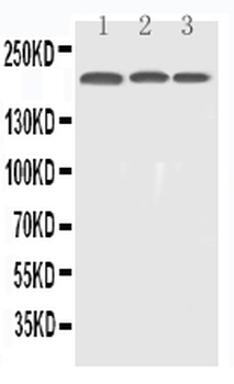 Anti-EGFR Antibody