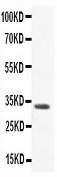Anti-CCL3/Macrophage Inflammatory Protein 1 alpha Antibody